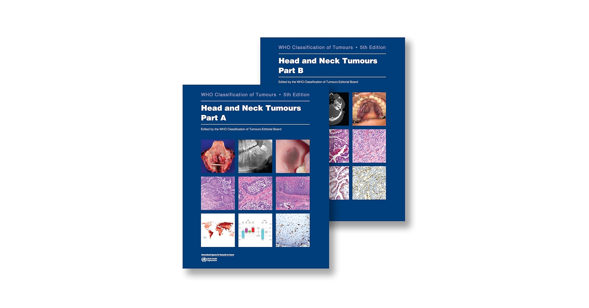 Head and Neck Tumours: WHO Classification of Tumours